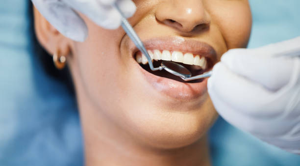 Best Pediatric Emergency Dentist in Winston, OR