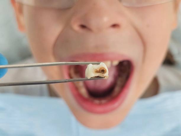 Best After-Hours Emergency Dentist in Winston, OR